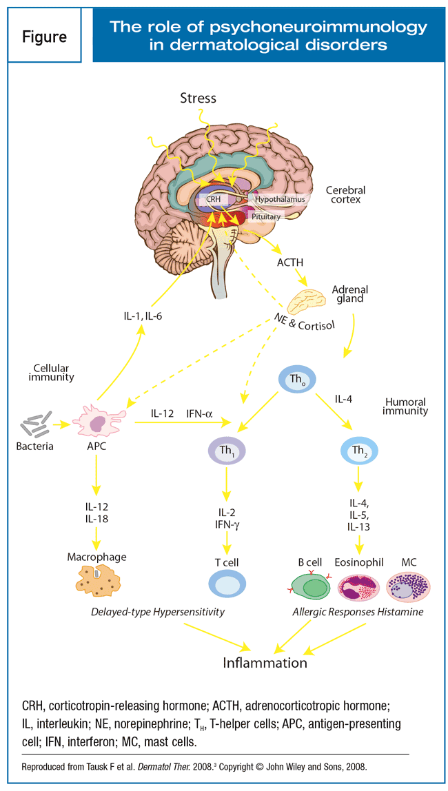 Understanding Psycho Dermatology: Exploring the Link Between Skin and ...